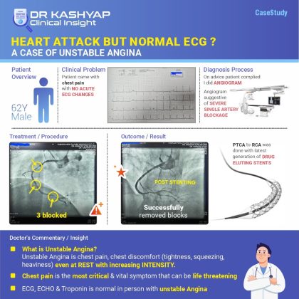 Heart attack but normal ecg a case of unstable angina