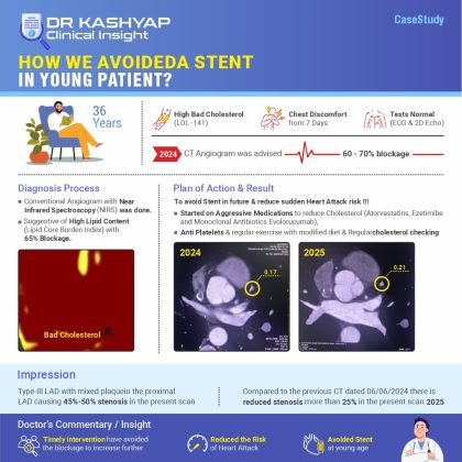 How we Avoid stent in Young Patient