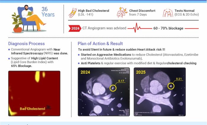 How we Avoid stent in Young Patient
